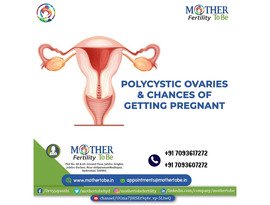 Best PCOS Treatment in Hyderabad | Best PCOS Specialist in Hyderabad