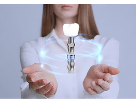 Leading Dental Implant OEM in USA | Siiodent Implants