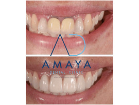 Best Dental Clinic in Bangalore | Top Dentist in Bangalore
