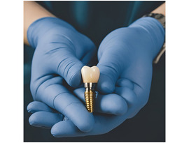 High-Quality Dental Implant Kit for Professional Use