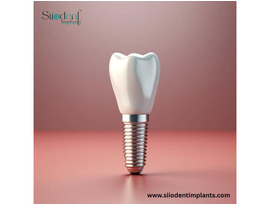 Dental Implant Manufacturers in Venezuela Driving Change