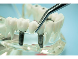 Explore Top Dental Instruments Suppliers for Every Need