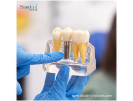 Explore OEM Partners in Paraguay for Top Quality Implants
