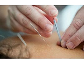 Bryant Park Acupuncture & Holistic Wellness in Midtown NYC